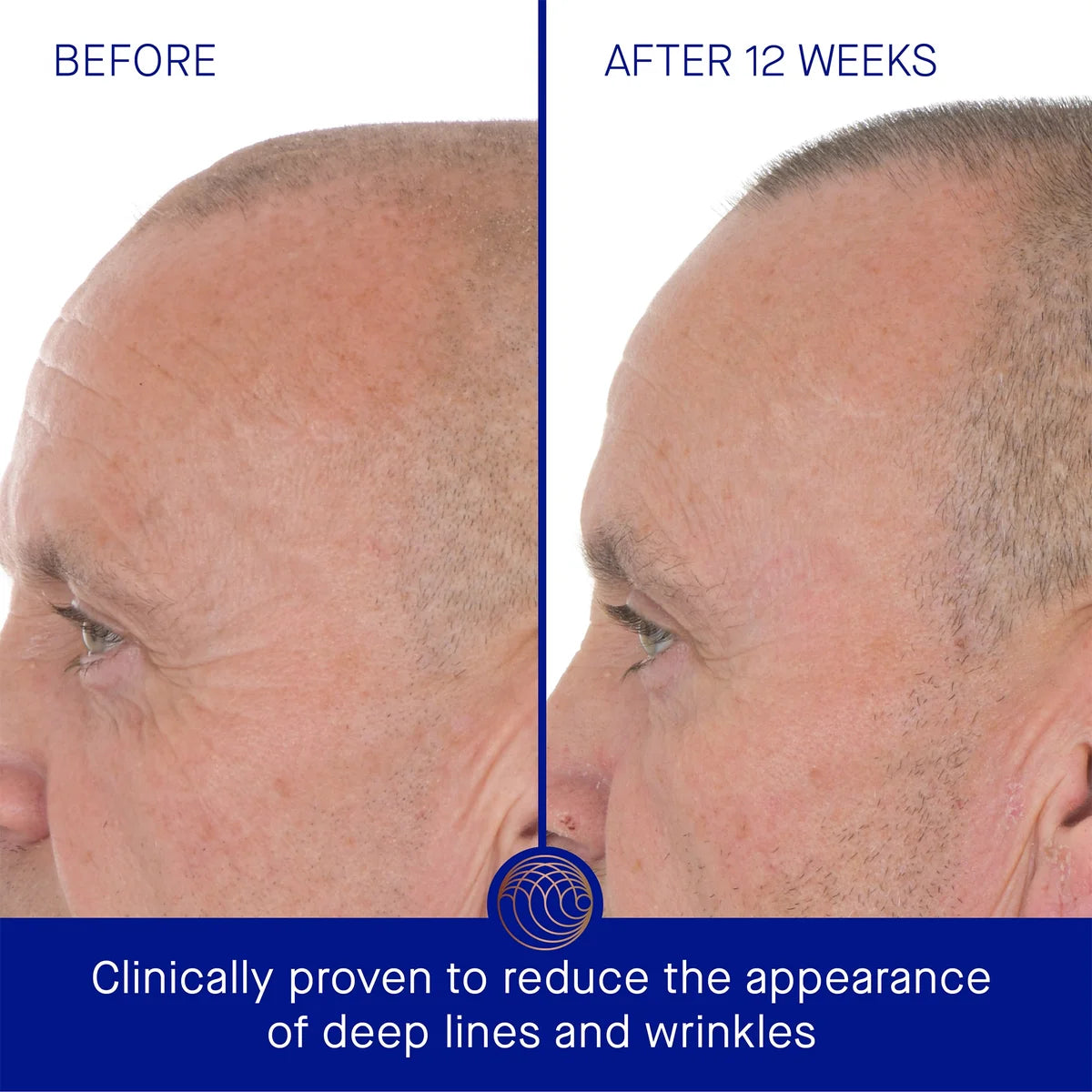 The Retinol Serum