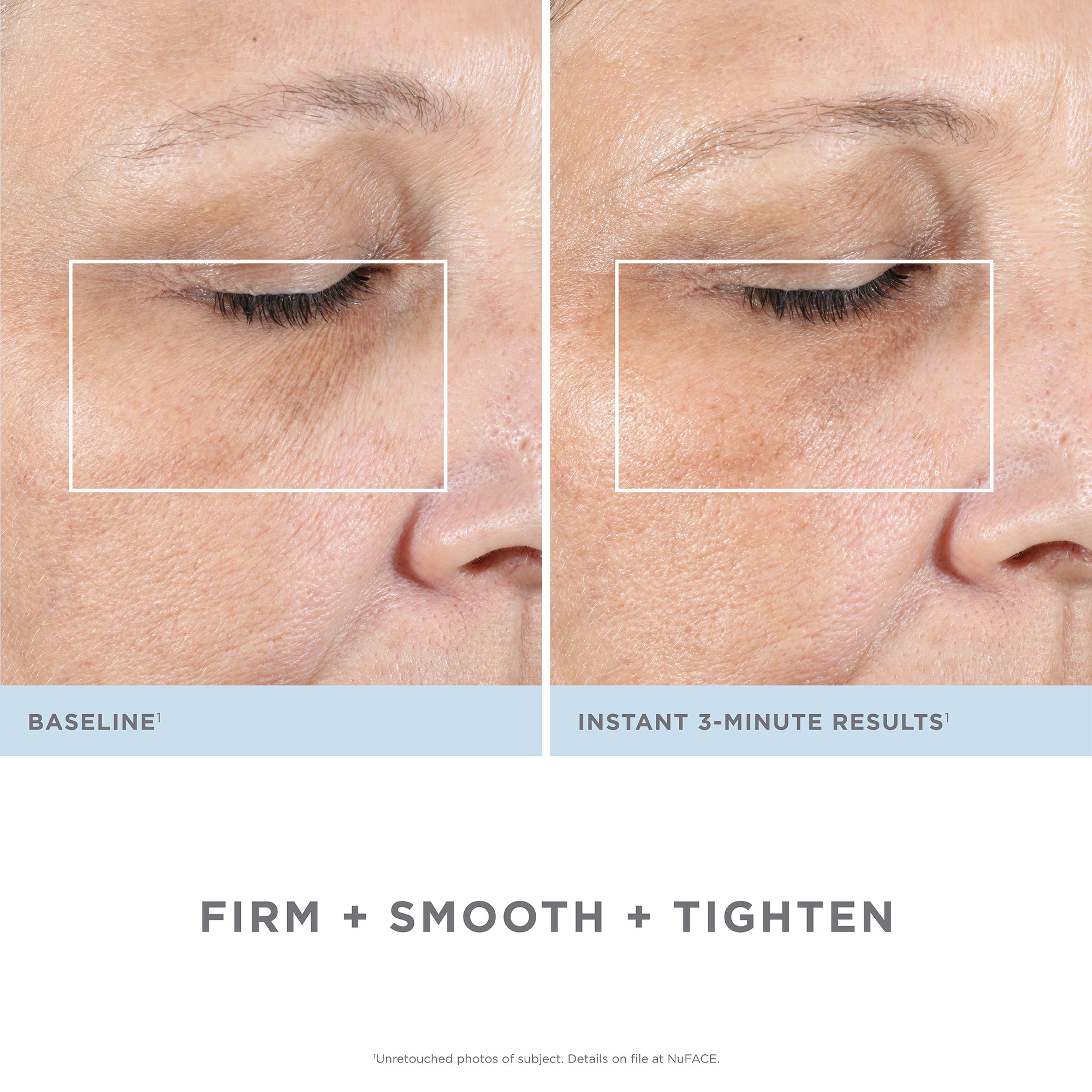 NUFACE FIX SMOOTHING DEVICE from NUFACE available online on Qiyorro