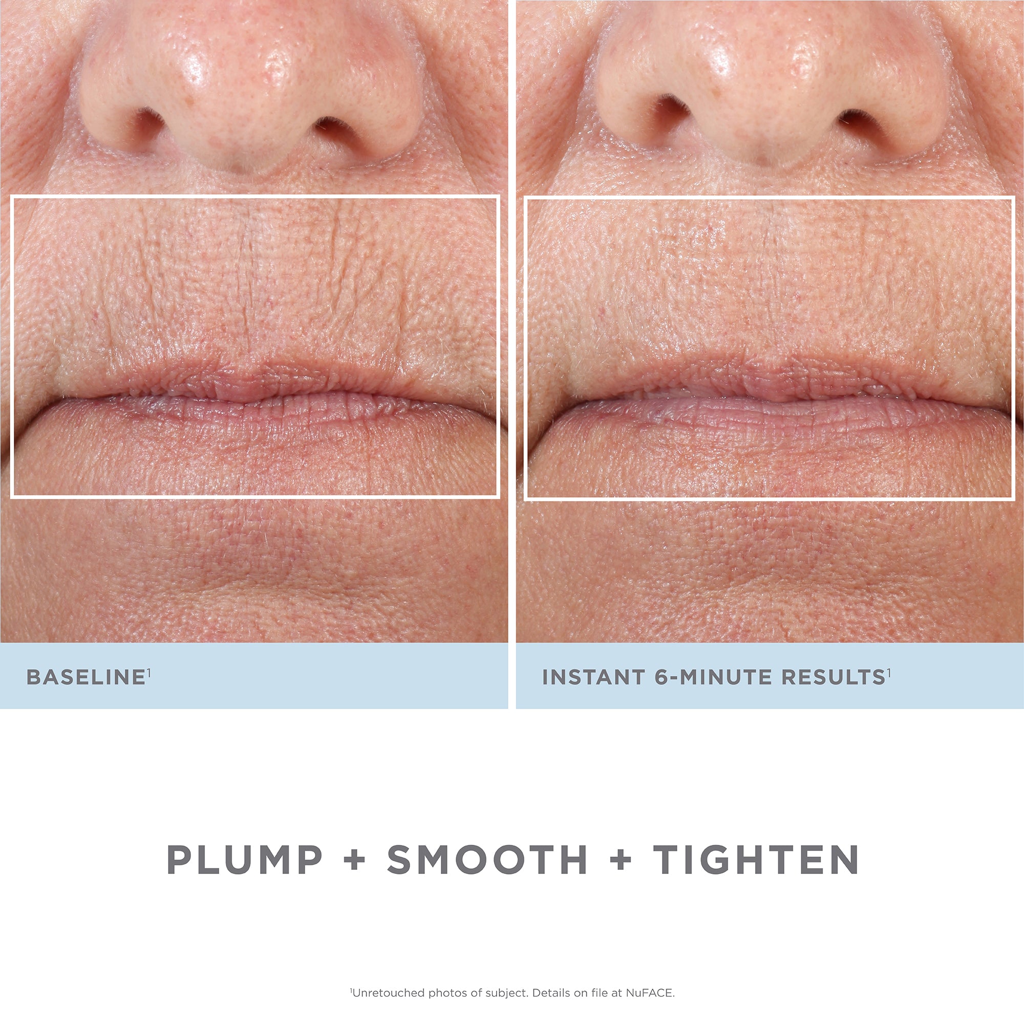 NUFACE FIX SMOOTHING DEVICE from NUFACE available online on Qiyorro