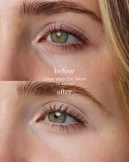 Grape water eye serum