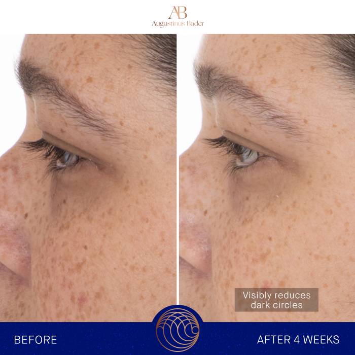 رقعة العين رقعة العين