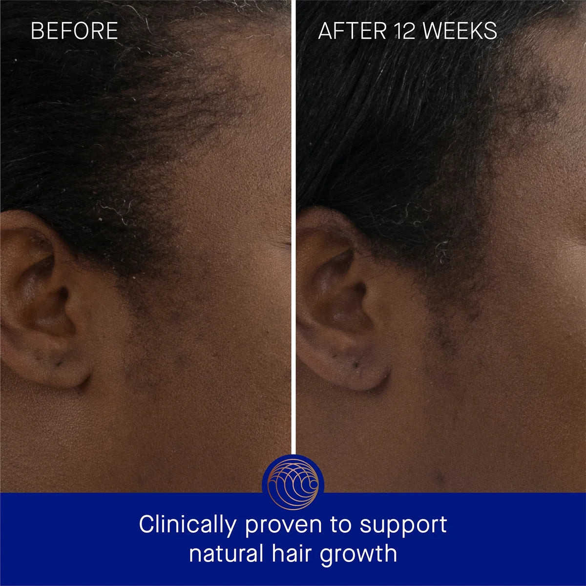 The Scalp Treatment The Scalp Treatment